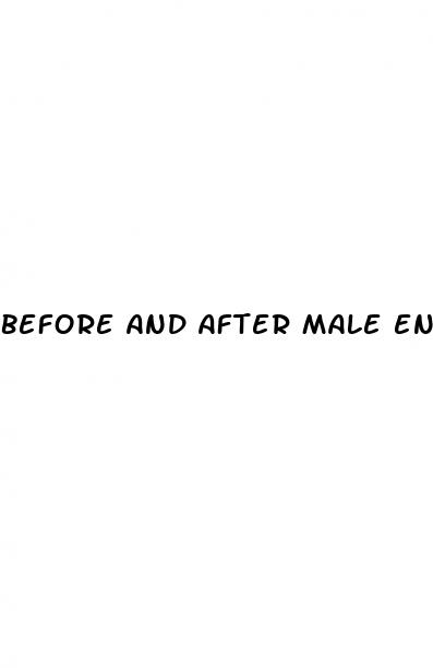 before and after male enhancement surgery