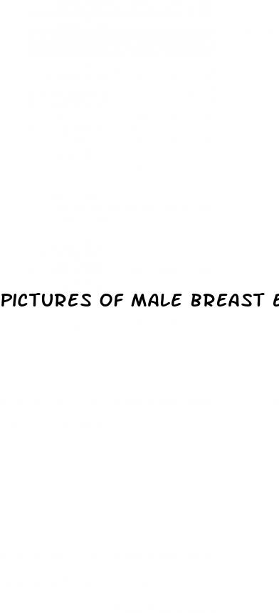 pictures of male breast enhancement
