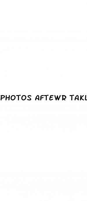 photos aftewr taklingf male enhancement poills