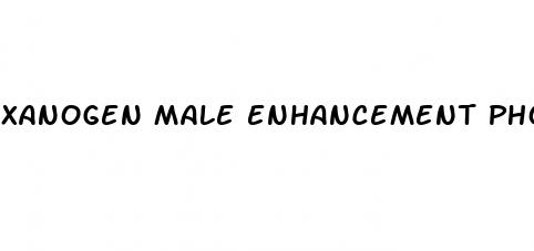 xanogen male enhancement phone number