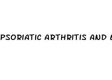 psoriatic arthritis and erectile dysfunction