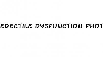 erectile dysfunction photos