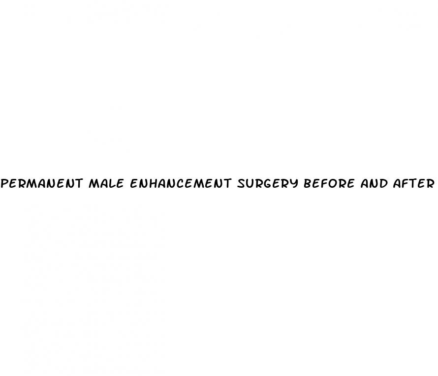 permanent male enhancement surgery before and after