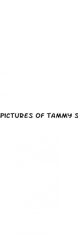 pictures of tammy slaton after weight loss