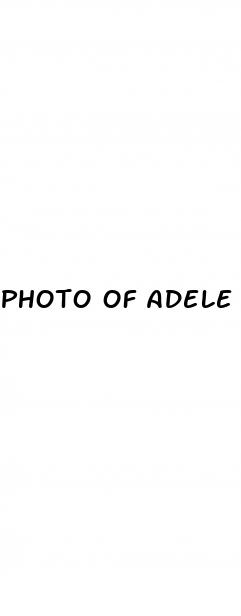 photo of adele with the weight loss