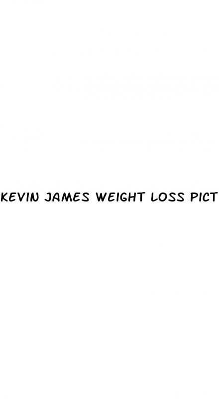 kevin james weight loss pictures