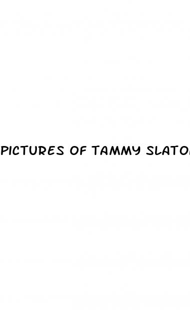 pictures of tammy slaton weight loss