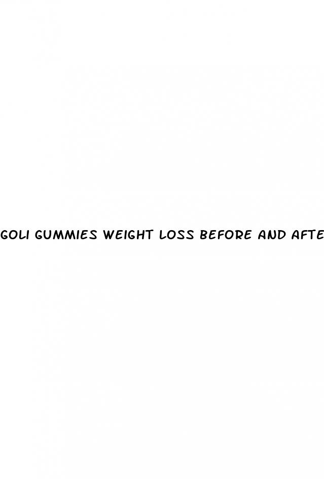 goli gummies weight loss before and after