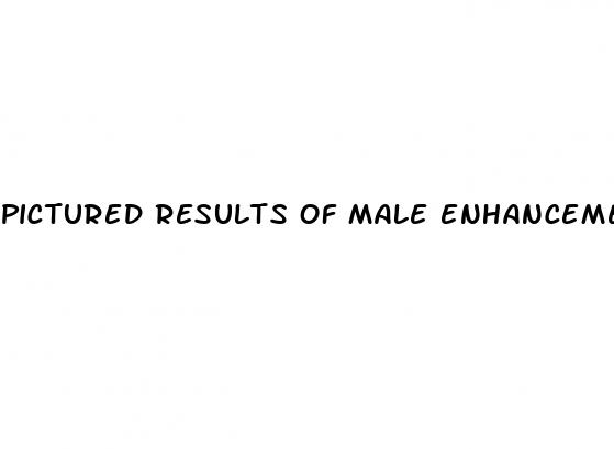 pictured results of male enhancement pills