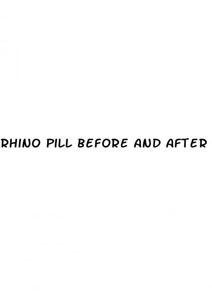 rhino pill before and after