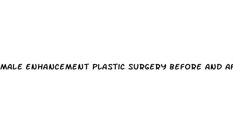 male enhancement plastic surgery before and after